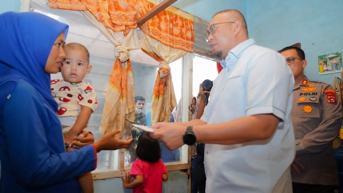 Andre Rosiade Salurkan Bantuan untuk Fatih, Balita Tiga Setengah Tahun yang Berjuang Melawan Tumor